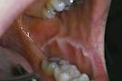 顎や歯が痛い…その原因は？